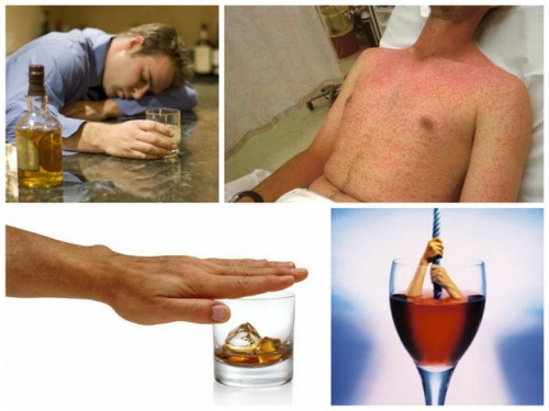 Основные подходы к лечению алкогольной зависимости